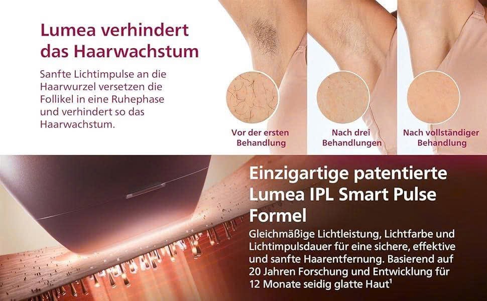 MÁY TRIỆT LÔNG PHILIPS LUMEA IPL 7000 – BRI923/00 - Hình ảnh 3