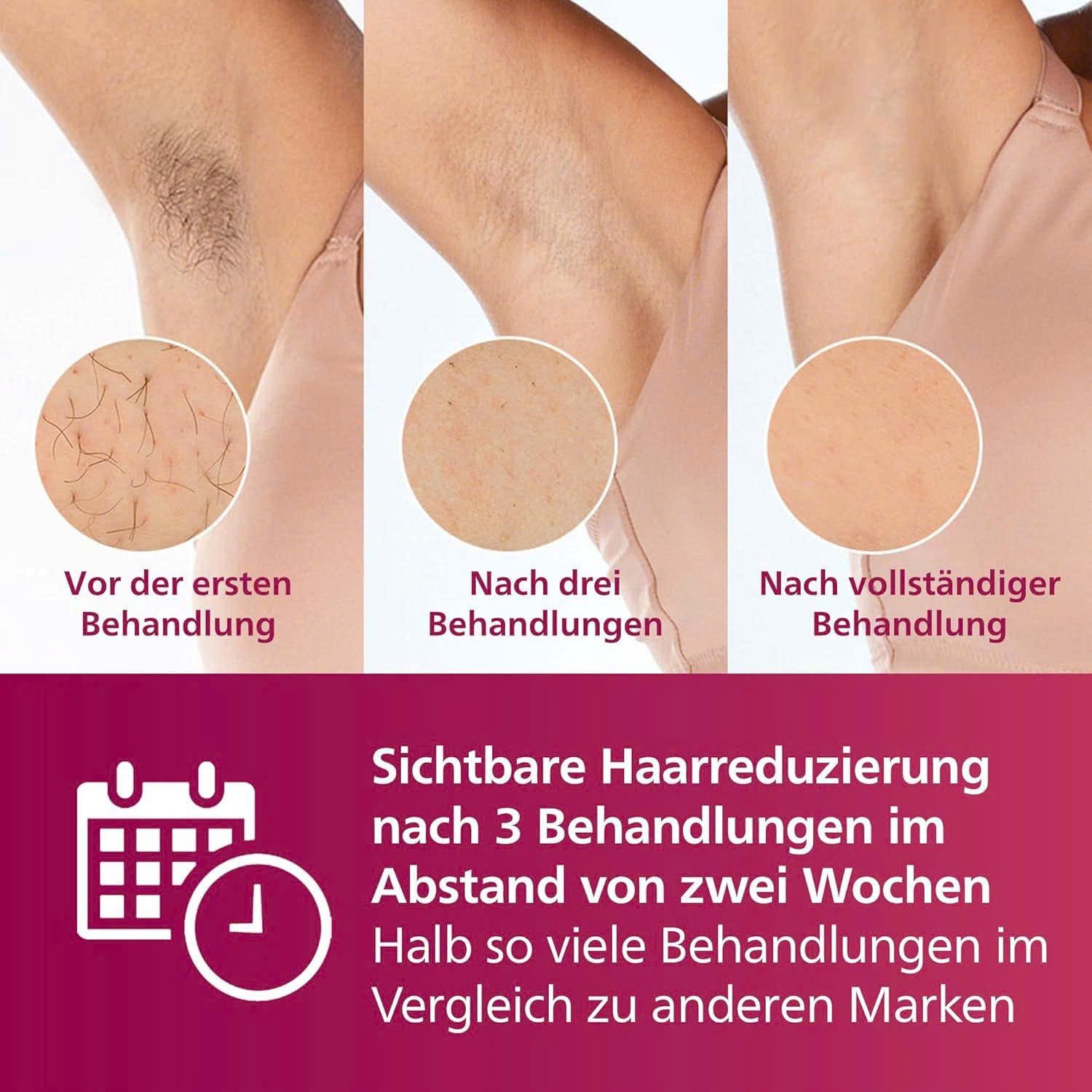 MÁY TRIỆT LÔNG PHILIPS LUMEA IPL 7000 – BRI923/00 - Hình ảnh 8