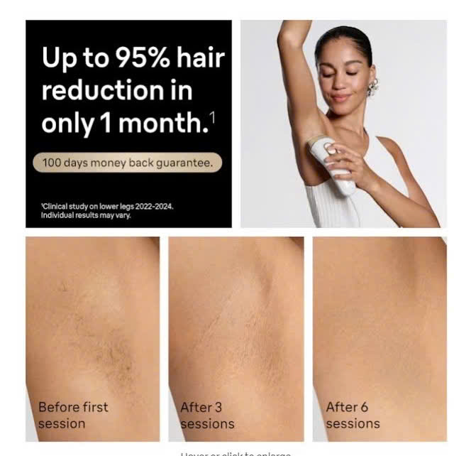 Máy Triệt Lông Braun Silk Expert Pro 5 IPL 5347 - Hình ảnh 4